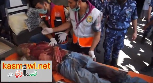 عاجل : 90 شهيدًا ومئات الجرحى حصيلة مذبحة الشجاعية وأبو مازن يعلن الحداد ثلاثة ايام